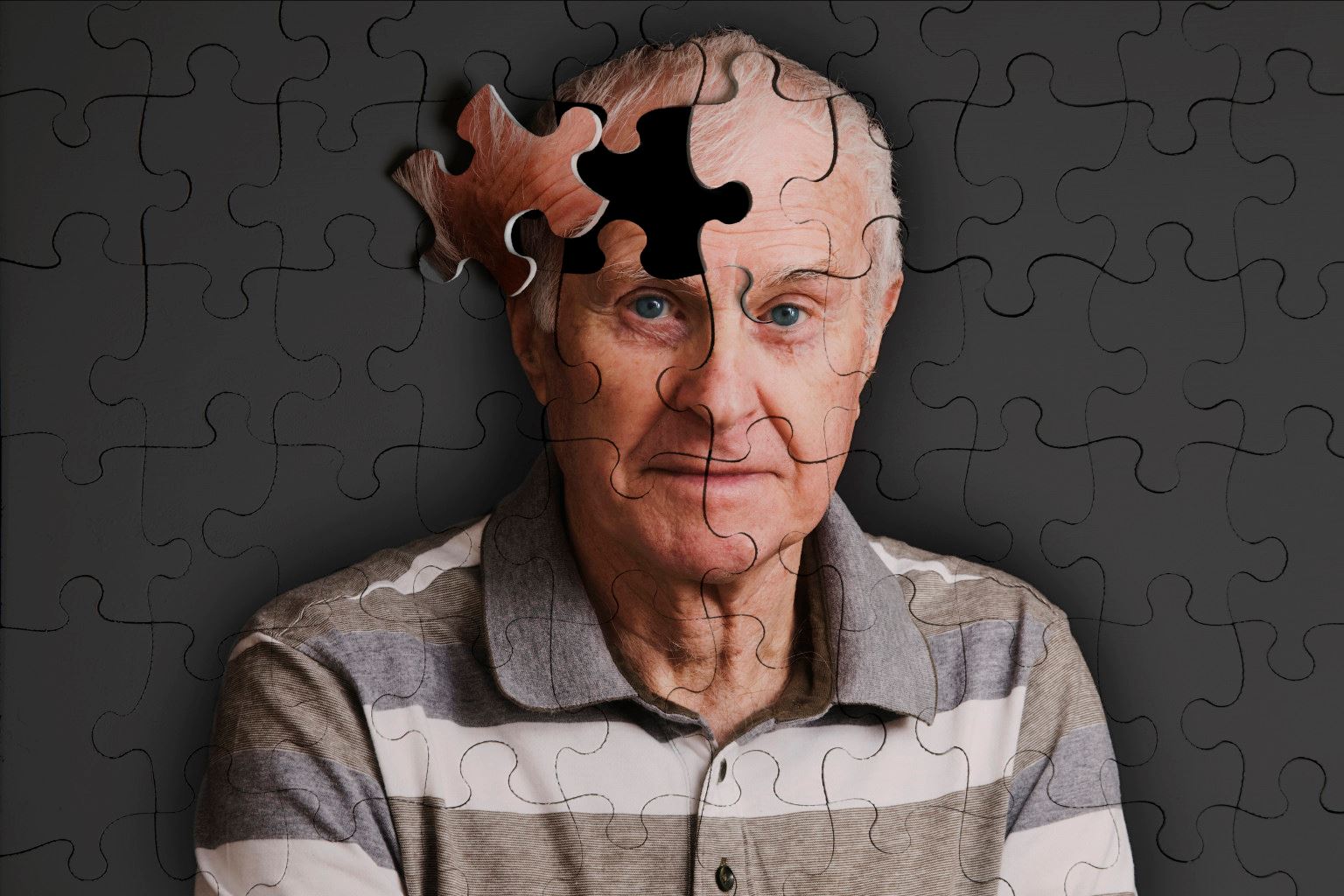 Alzheimer prevenzione